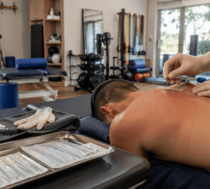 Physiotherapist performing dry needling therapy on a patient's upper back in a modern physiotherapy clinic with rehabilitation equipment and natural daylight.